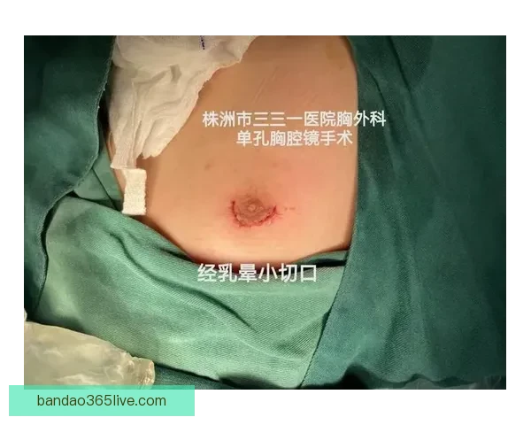 坎宁安气胸康复持续推进 活塞计划一周后复查评估